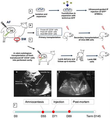 In utero therapy for congenital disorders using amniotic fluid stem cells